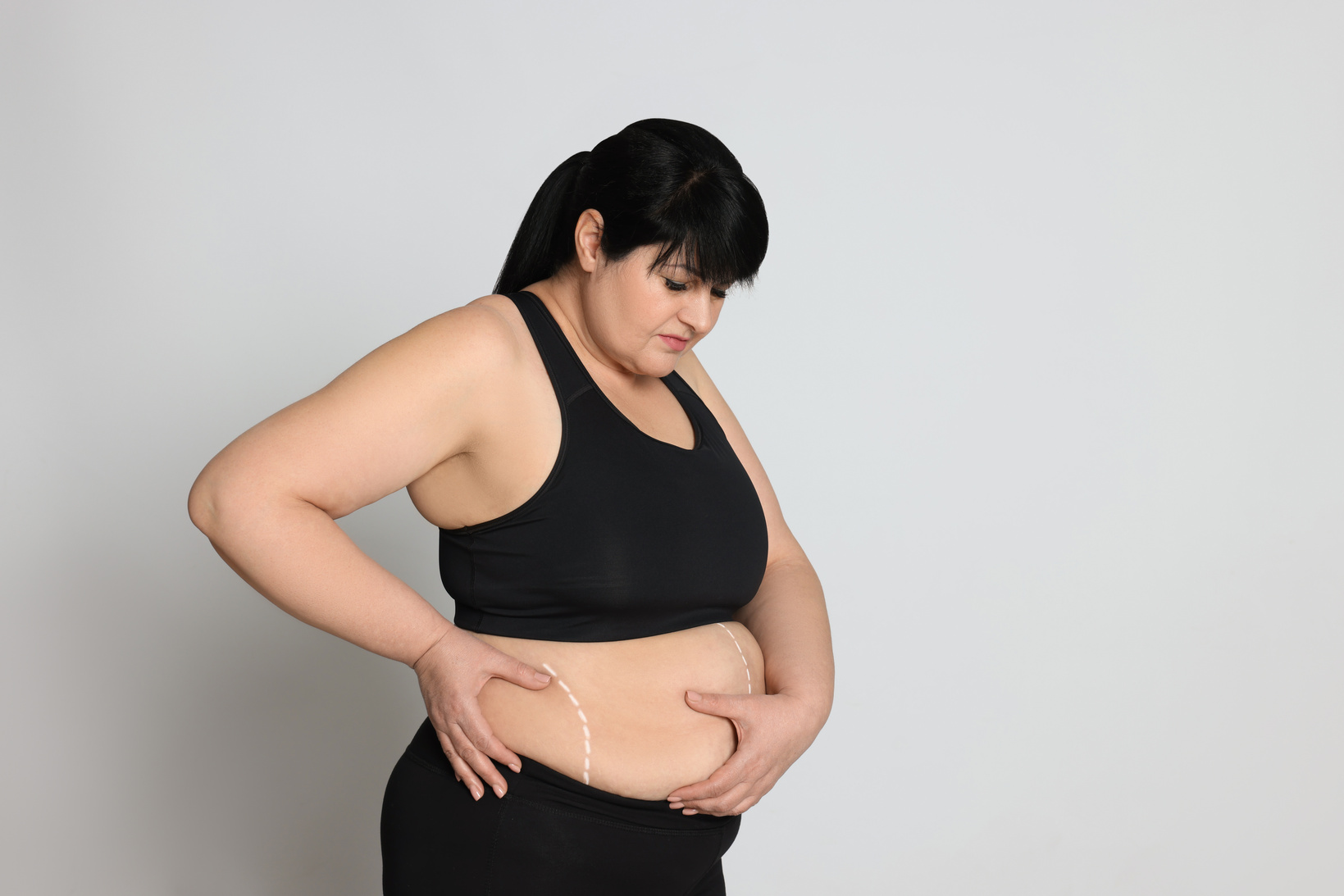 Obese Woman with Marks on Body against Light Background, Space F
